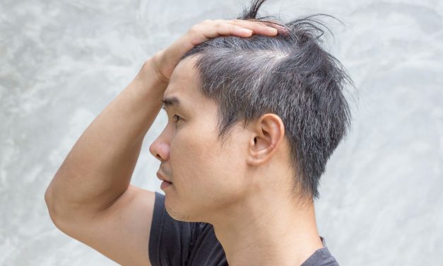 Ubanan Karena Stres Ternyata Bisa Hitam Lagi, Kok Bisa?